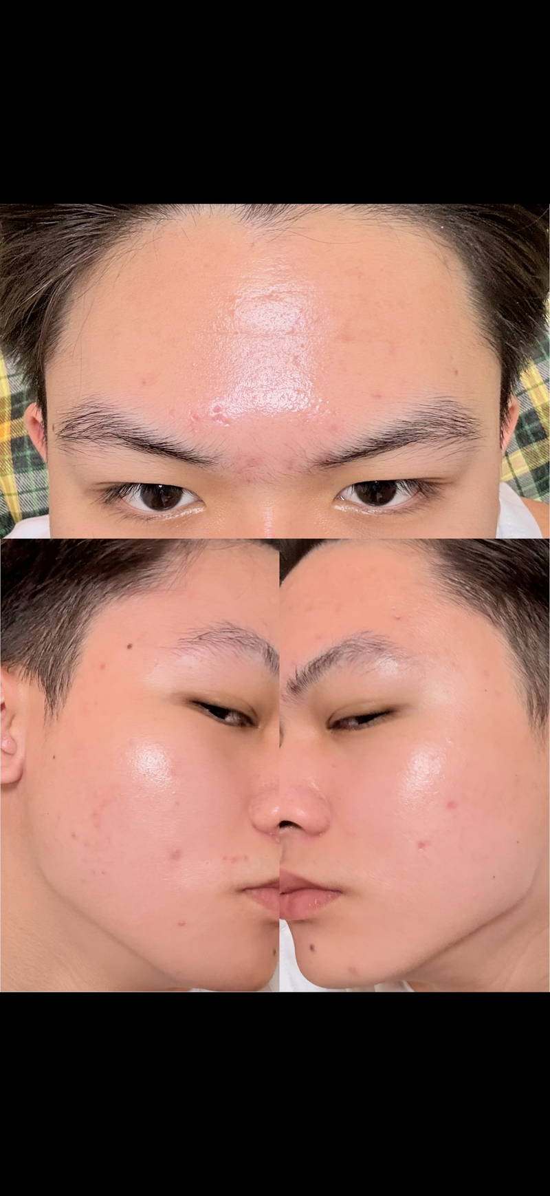 After image
