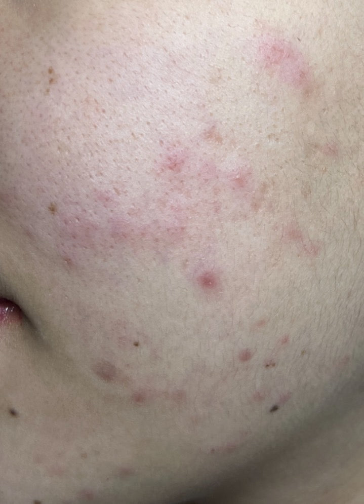 Before image